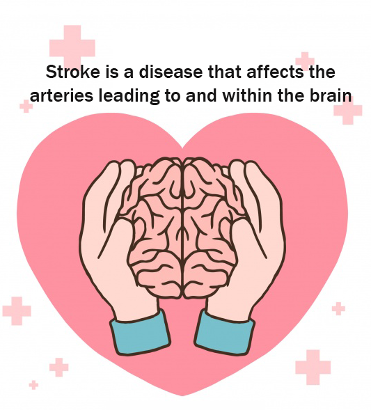 brain stroke treatment