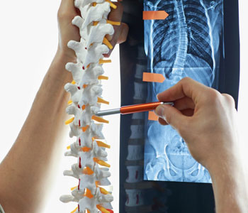 ataxia treatment
