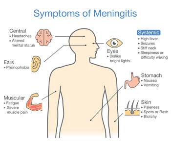 menigities treatment