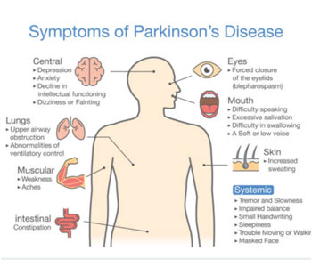 parkinsons disease treatment