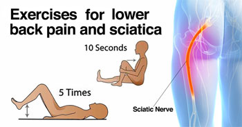 sciatica treatment