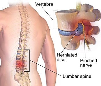 spine surgeon in Hyderabad